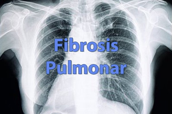 ¿Qué es la fibrosis pulmonar?