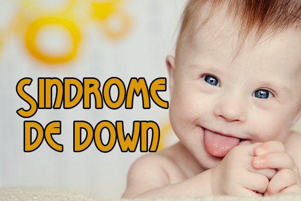 Cómo atender una persona con Síndrome de Down