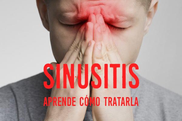 ¿Qué es la sinusitis?