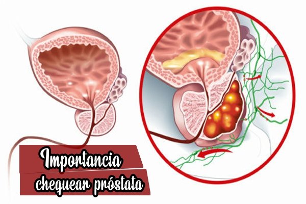 Cuidado Proactivo de la Próstata: La Clave para una Vida Saludable